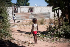 Malnutrition in Global Health 2050